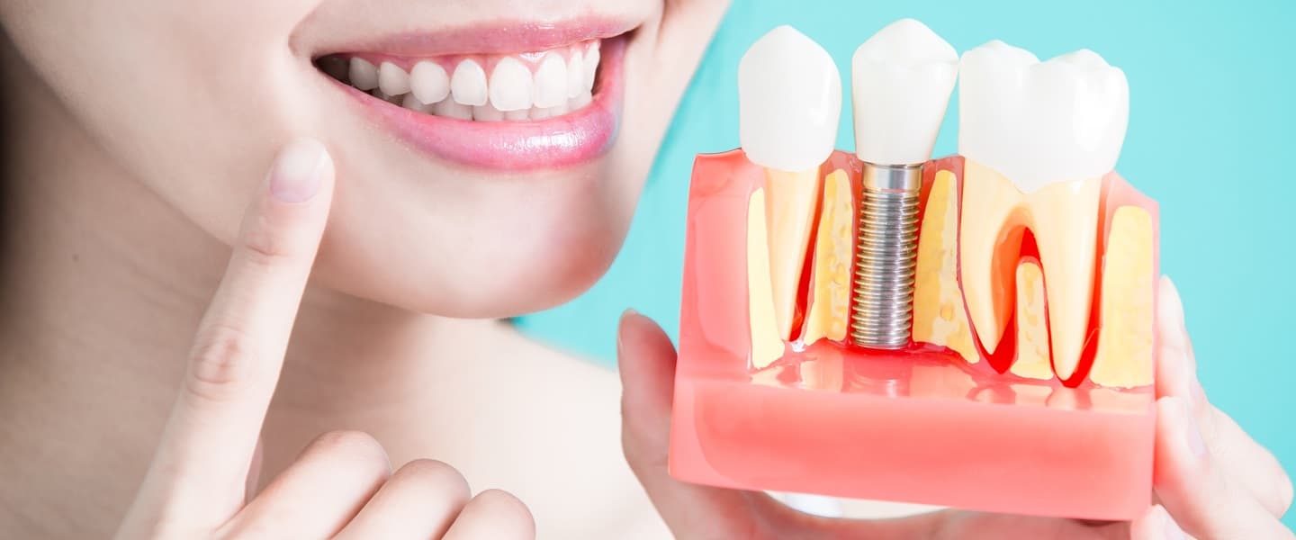 Dentist Kellyville